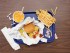 Obesity and health risks
