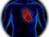 heart disease