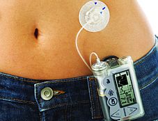 Insulin_pump