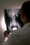 xray-lumbar