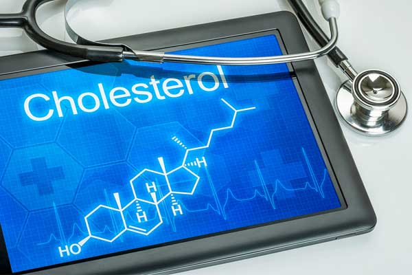 Cholesterol-Results-Revisited